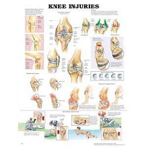 Anatomical Chart Company Knee Injuries Chart  Industrial 