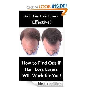 Are Hair Loss Lasers Effective? Save Money and Time How to Find Out 