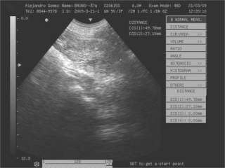   ob gyn reproduction small parts cardiology etc display modes b b