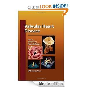 Valvular Heart Disease (Contemporary Cardiology) Andrew Wang, Thomas 