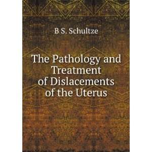  The Pathology and Treatment of Dislacements of the Uterus 