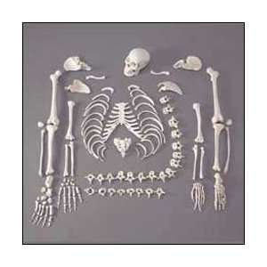 Anatomical Chart Company   1/2 Disartic. Budget Skel w/Skull  
