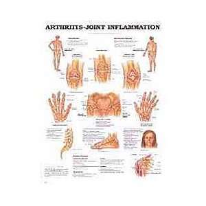  Arthritis / Joint Chart